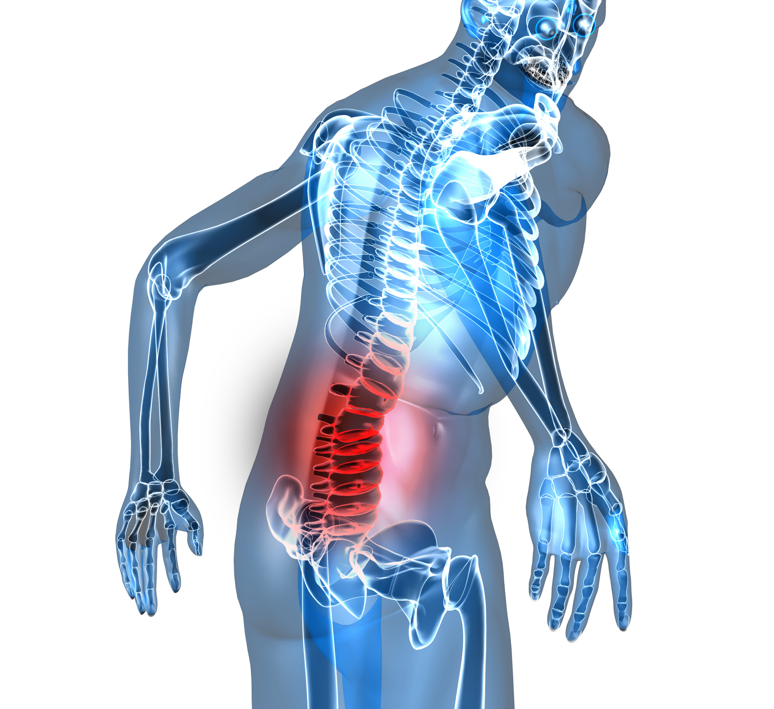 5-common-causes-of-low-back-pain-dr-martin-schmaltz