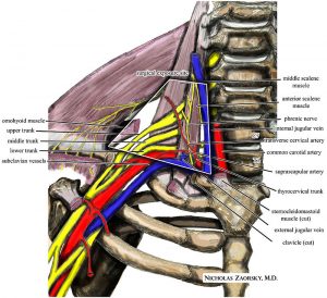 Thoracic Outlet Syndrome. License: Creative Commons Attribution-Share Alike 3.0