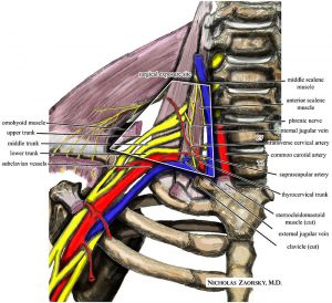 injury blog: thoracic outlet syndrome