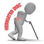 Herniated disc